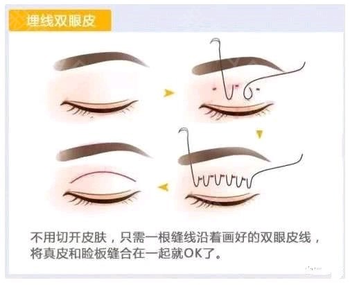 图像采集卡的种类和区别-kaiyun开云官方在线登录